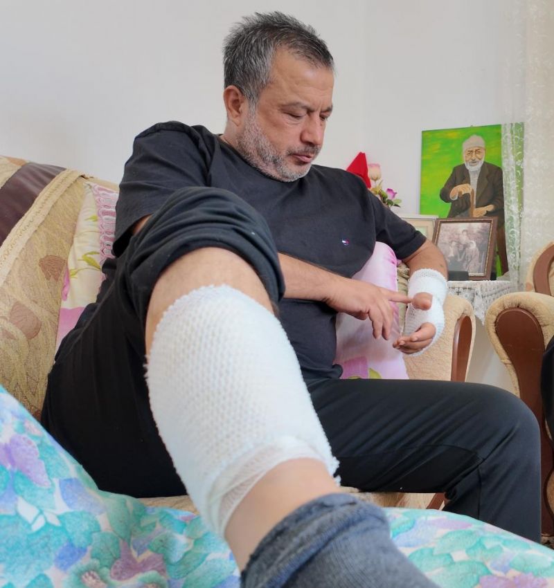 Sahipli köpeğin saldırdığı adam feci şekilde yaralandı